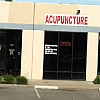 Acupuncture Therapy